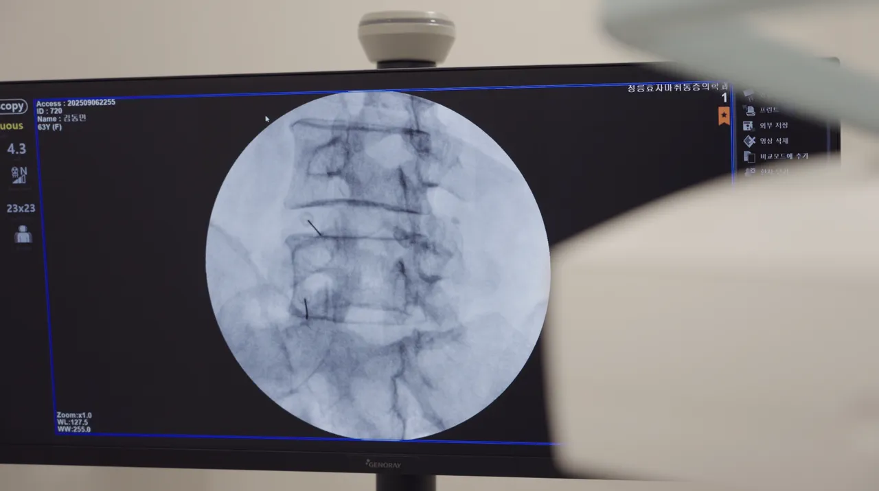 도수치료자료 5